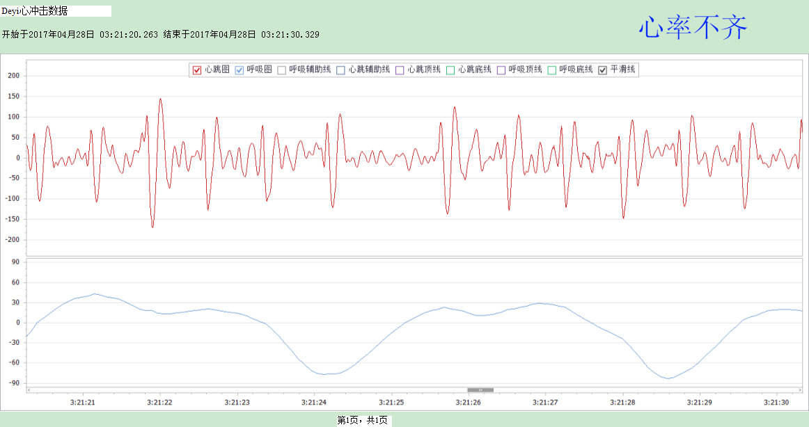 心律不齐.jpg